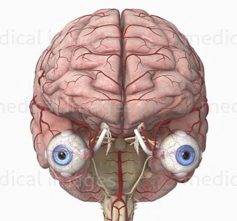hypercerebrum