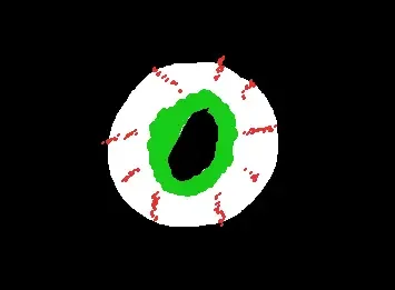 Eye
