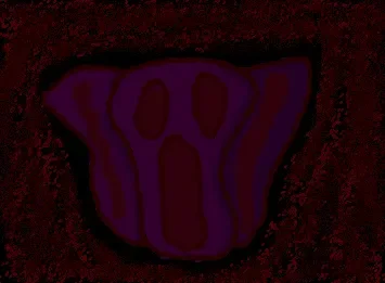 (REDACTED.) {DESCRIPTION}