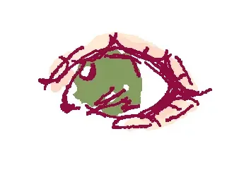 eye