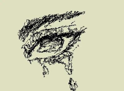 Eye