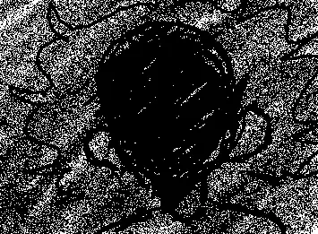 Dissociation