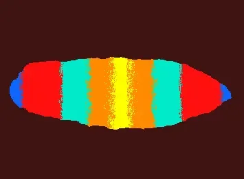 eye?