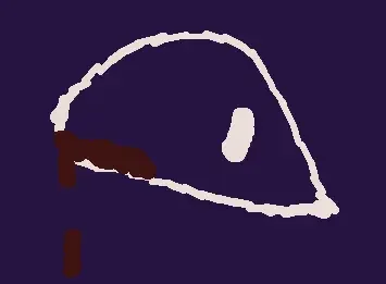 bleeding eye problem