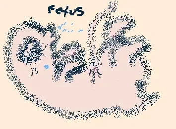 Fetus