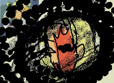 Depression