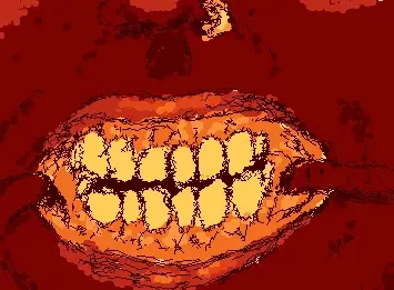 somethn in my teeth??