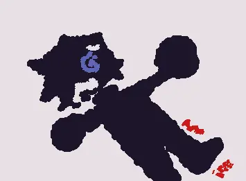 leg pain
