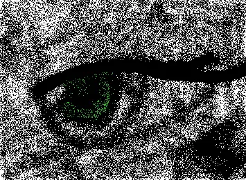 Eye