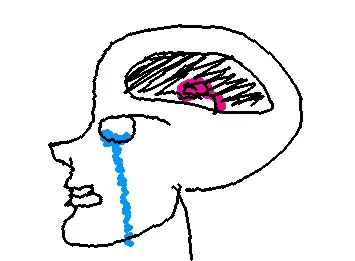 Small brain