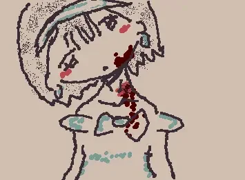 sua alnst dead what