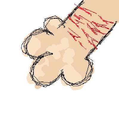 My mutilated arms...
