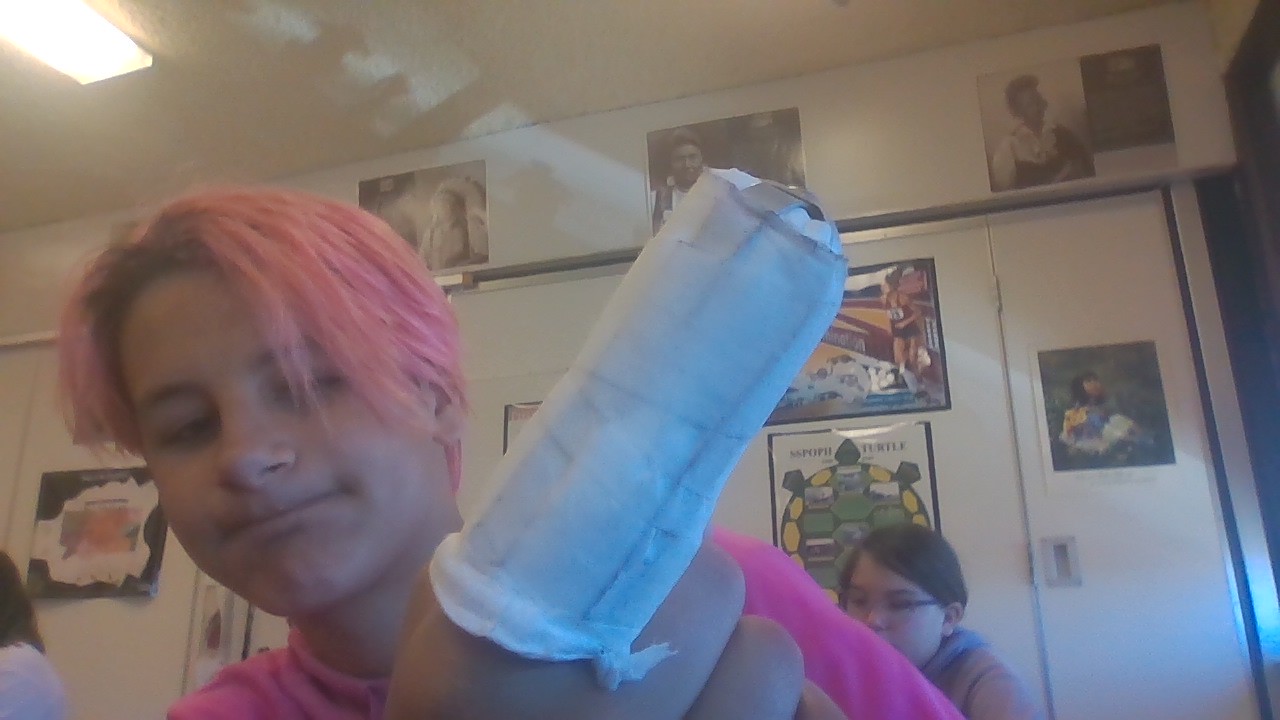 sprained my finger during kickball