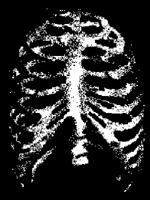 Ribcage