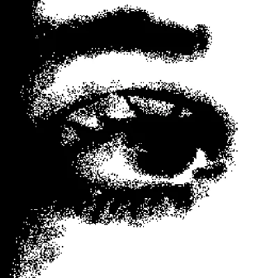 Eye