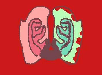 Smoker's Lung
