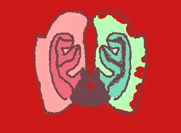 Smoker's Lung