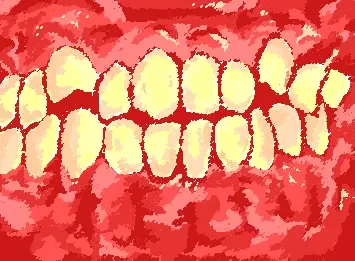 theeth