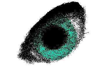 Eye