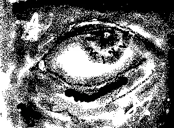 eye