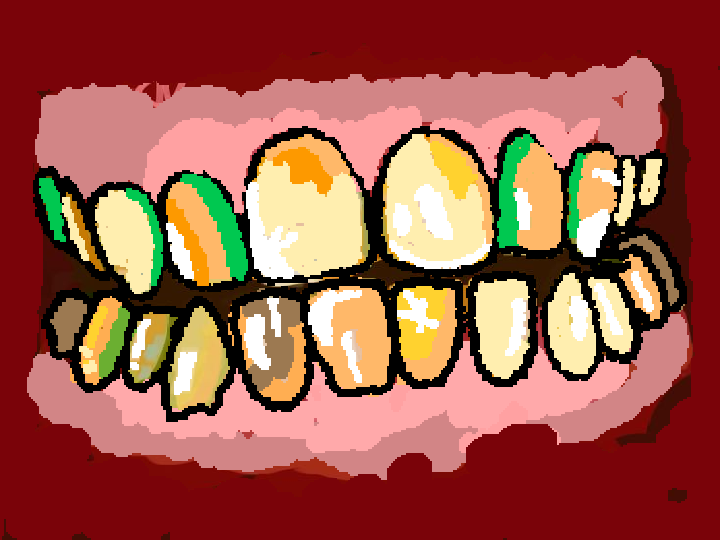 Teeth..
